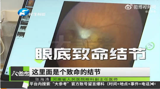 8歲女孩玩貓狗感染眼弓蛔蟲致失明 醫(yī)生：早期癥狀不明顯很難發(fā)現(xiàn)