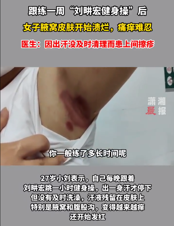 女子跟劉畊宏跳操未及時(shí)洗澡致腋窩潰爛 網(wǎng)友“越來(lái)越離譜了”