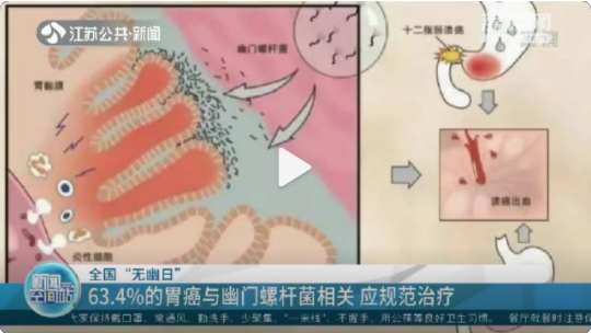 24歲女孩感染幽門(mén)螺桿菌確診胃癌晚期 超過(guò)6成胃癌與幽門(mén)螺桿菌相關(guān)