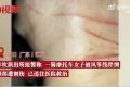 女子騎車脖子遭橫空風(fēng)箏線割傷 緊繃的風(fēng)箏線宛如一把鋸子